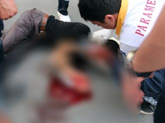 Kafasından Traktör Geçti
