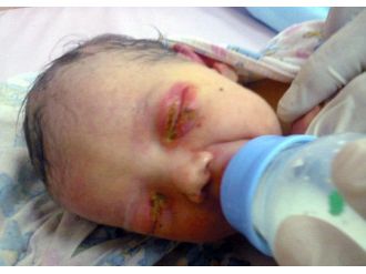 3 Günlük Bebeği Bu Hale Karıncalar Getirdi