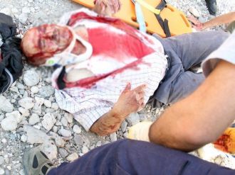 Otomobil 10 Metrelik Şarampole Yuvarlandı: 3 Ağır Yaralı