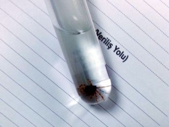 Adıyaman’da Kenenin Isırdığı Genç Kız Hastaneye Kaldırıldı
