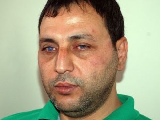 29 Yaşından Sonra Dünyası Karardı