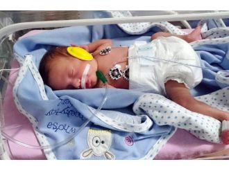 (Özel Haber) Erken Doğan Bebek İçin Hava Ambulansı
