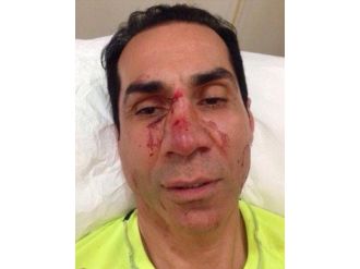 Belediye Meclis Üyesi, 3 Kişinin Saldırısına Uğradı