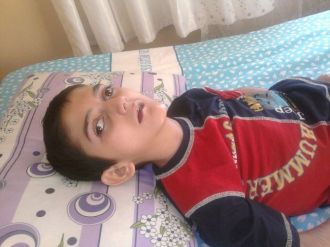 Sspe Hastası Alagöz, Yardım Bekliyor