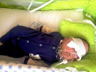 (Özel Haber) Beyni Gözüne İnen Minik Muhammed Yardım Bekliyor