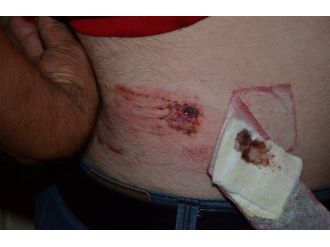 Bimer’e Şikayet Eden Komşusunun Dükkanını Orakla Bastı