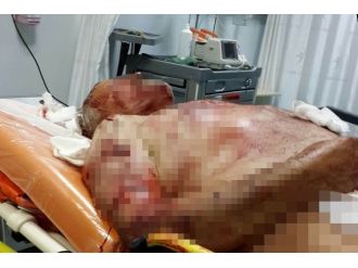 Samsun’da Köpek Dehşeti