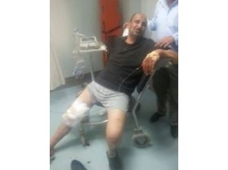 Ayının Saldırısına Uğradı