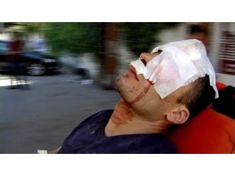 Uludağ’ın Eteğinde Dinamit Bomba Gibi Patladı: 2 Defineci Öldü, Birisi Yaralı 4 Kişi Kurtuldu