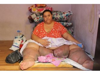 Tek Göz Odada 220 Kiloyla Yaşam Savaşı
