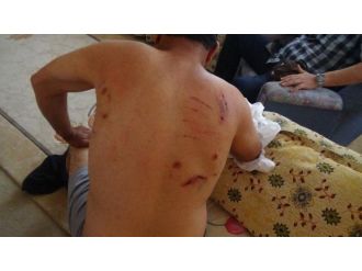 Ayı Saldırısı Bu Hale Getirdi