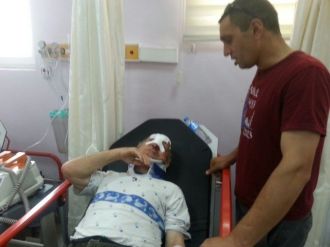 Bartın’da Ağaçtan Düşen Yaşlı Adam Yaralandı