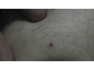 Kulu’da Kene Vakaları Çoğaldı