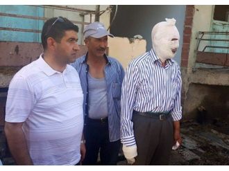 Çorum’da Yangın: 1 Yaralı