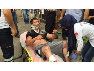 Vücut Geliştirme Şampiyonu Feci Şekilde Darp Edildi