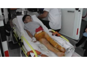Üzerine Kaynar Su Dökülen 4 Yaşındaki Çoçuk Yaralandı