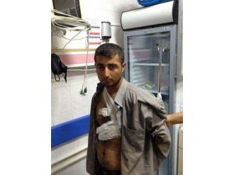 Polis Memurunu Şehit Eden Pkk’lıya Devlet Şefkati