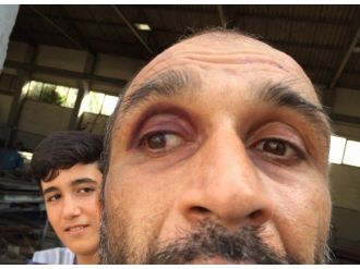 Bakım Merkezindeki Hasta Darp Raporu Aldı