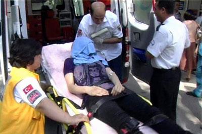 Deney yapan öğrencinin yüzü yandı 