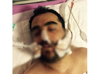 Sokakta Yaralı Halde Bulunan Şahıs Hastaneye Kaldırıldı