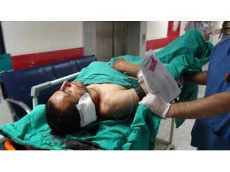 Pompalı Tüfekle Vurdular, Yetmedi Kulağını Kestiler