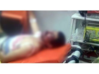 Yaralı Teröriste Linç Girişimi !