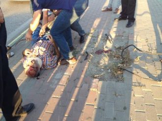 Motosiklet Çarptığı İçin Değil, Kaldırımdaki Vida Yüzünden Ölüyordu