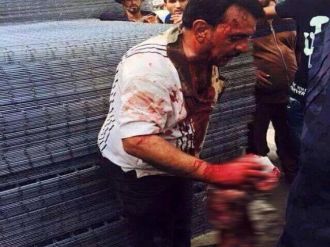 Sosyal Medyadaki Pkk Propagandasına Dikkat !