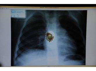 36 yıllık doktorun ilginç koleksiyonu