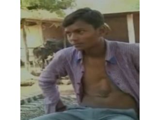 Ölümle burun buruna yaşıyor