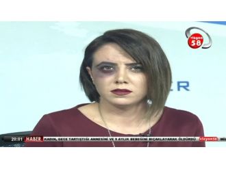 Canlı yayına morarmış gözle çıktı