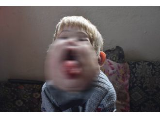 Minik İsmail yardımlarınızı bekliyor