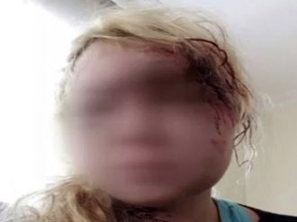 Şİkayete gittiği karakolda cinayetten tutuklandı !