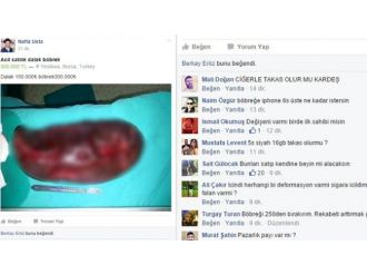 İnternette ’acil satılık dalak böbrek’ ilanı