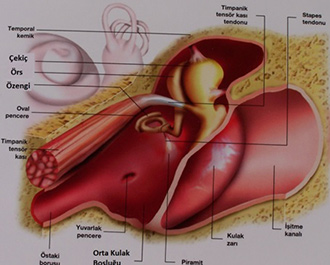 Orta Kulakta Su Toplanması Nedir?