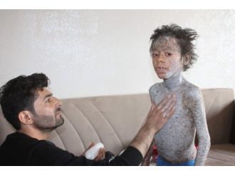 Küçük Melih yardım bekliyor