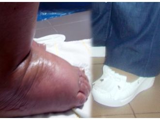 31 yıl sonra ilk kez ayakkabı giydi