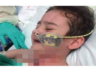 7 yaşında 61 ameliyat: Minik Kayra yardım bekliyor