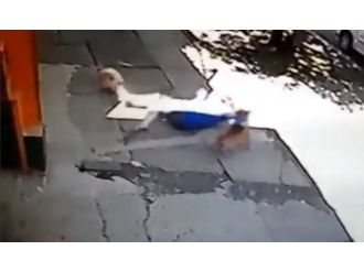 Pitbull kadın ve köpeğine böyle saldırdı