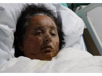 Onu bu hale 20 yıllık kocası getirdi !