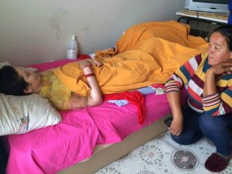 Kezzapla yakılan kadının en büyük isteği...