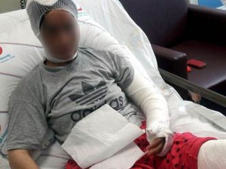 İşkence gören kadının anlattıkları kan dondurdu