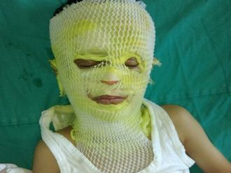 Tehlikeli oyun, çocuğu bu hale getirdi