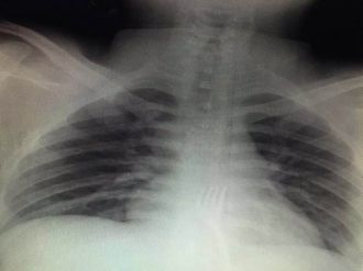 Midesinden çıkanı görünce "bunu nasıl yutmuş" diyeceksiniz