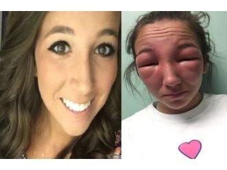 Piknik sonrası bu hale geldi