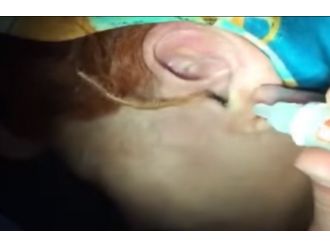 Kulağından kırkayak çıktı