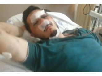 Dehşet anlarını kaydetti