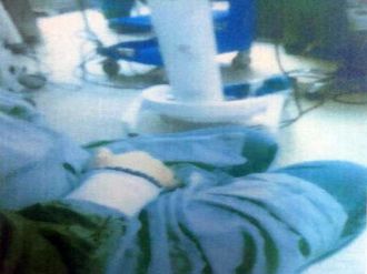 Baygın halde hastaya bunu yaptı