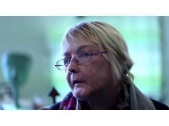 Dünyanın ilk yüz nakli yapılan insanı hayatını kaybetti