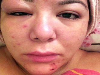 Reddedilince bu hale getirdiler